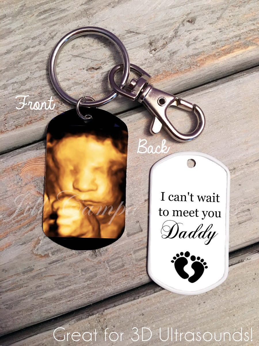 Sonogram picture keychain online