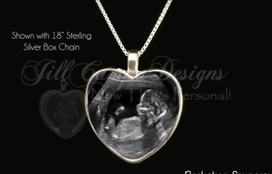 Baby Sonogram Jewelry is really a thing!