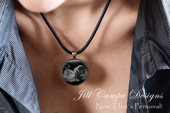 Baby SONOGRAM Necklace, Ultrasound Pendant - leather cord necklace - Jill Campa Designs - Now That's Personal! 
