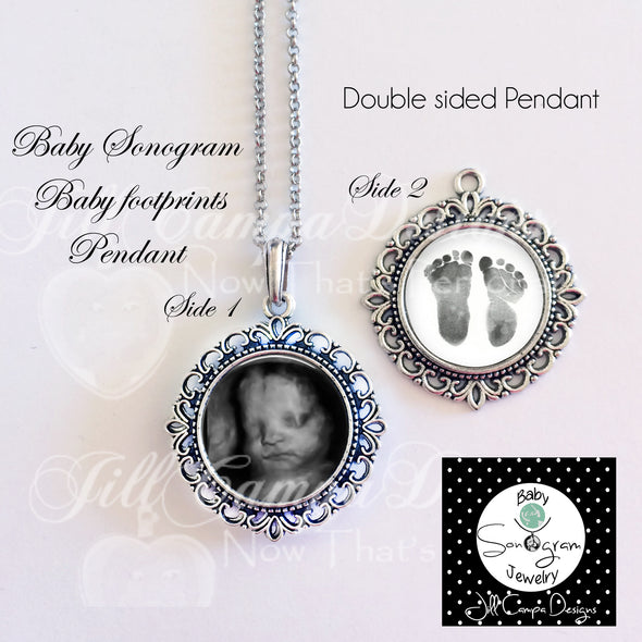SONOGRAM NECKLACE - Baby footprint necklace - 2 sonograms - fancy edge - 2 sided baby sonogram pendant - Jill Campa Designs - Now That's Personal! 