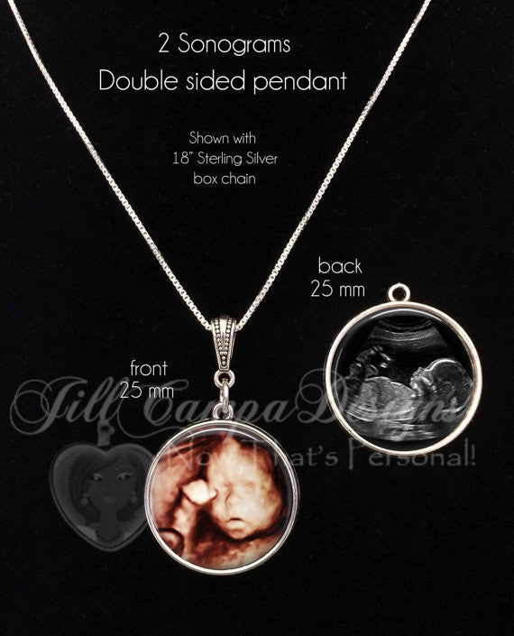 SONOGRAM NECKLACE - 2 sonograms - 2 sided baby sonogram pendant - Jill Campa Designs - Now That's Personal! 