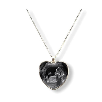 BABY SONOGRAM Heart Shaped Necklace